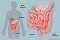 Información sobre la Irrigación de Colon